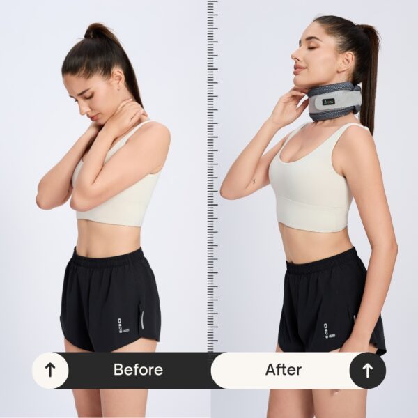 Spacer Fabric Neck Brace Cervical Collar for Relief of Cervical Spine Pressure for Women & Men - Image 4